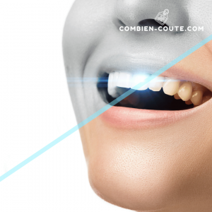 un blanchiment des dents